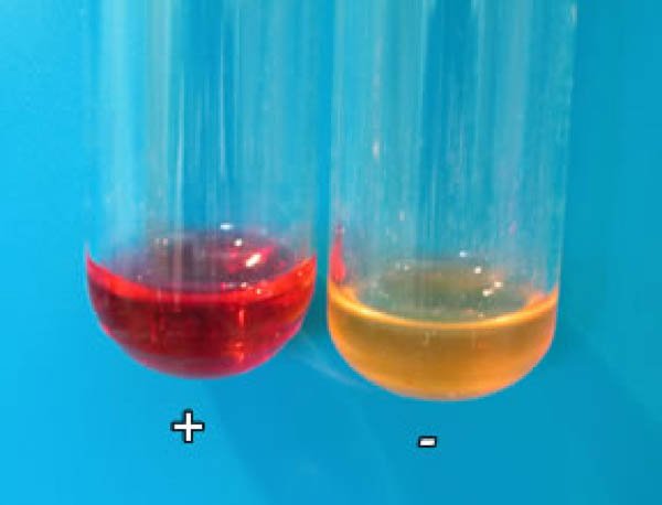 Result of the Methyl Red (MR) test. The yellow color of media means the test organism is (MR) test negative and red color means the test organism is (MR) test positive.