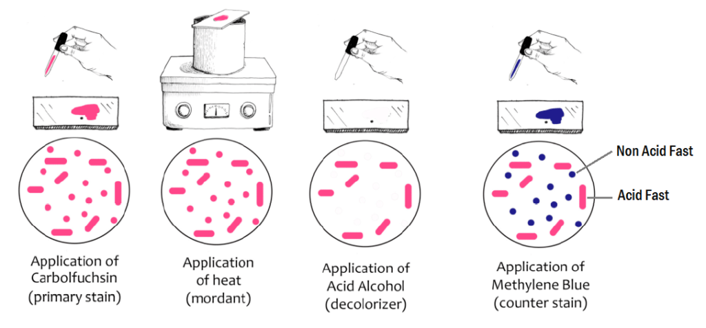 Steps of Acid Fast staining method