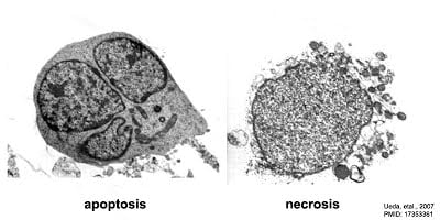 Apoptosis and Necrosis