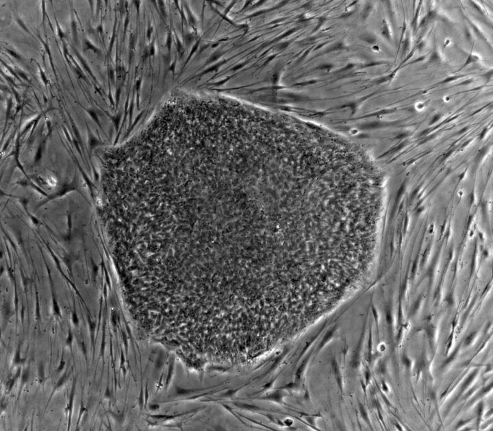 Stem Cell
