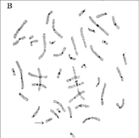 Chromosome Banding - C Banding