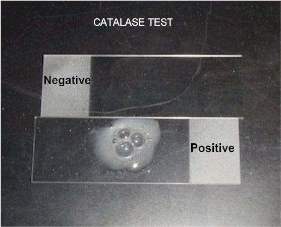 Catalase test