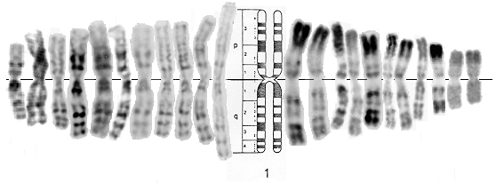 Chromosome Banding - R Banding