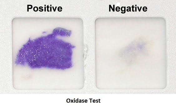 Oxidase test