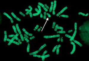 Chromosome Banding - Q banding